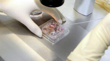 Cum vor fi alese cuplurile pentru fertilizare in vitro gratuită