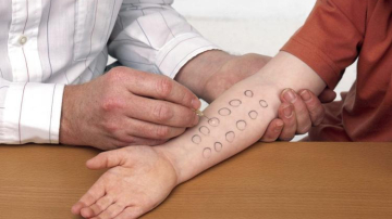 Diagnosticul de laborator la alergeni. O trecere în revistă a laboratoarelor din Chişinău unde puteţi face testele alergologice