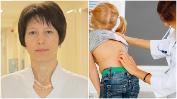 Scolioza la copii. E vinovat oare ghiozdanul?