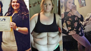6 пакетов лишней кожи: американка похудела на 80 килограммов и поделилась фото