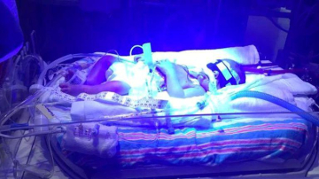 Gest emoționant! Ce a făcut un bebeluș sănătos lângă fratele lui geamăn, aflat în stare gravă