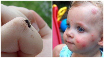 Care vitamină ține țânțarii la distanță