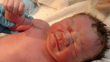 Un nou născut a venit pe lume cu steriletul mamei în mână