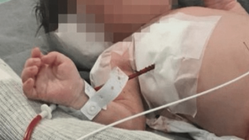 В Бразилии спасли ребёнка, в которого попала пуля в утробе матери