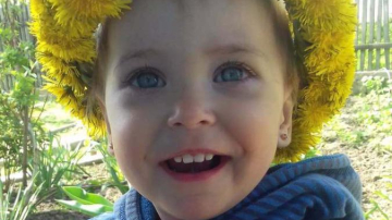 Sarra Anton a suferit arsuri pe 40% din suprafața corpului. O putem ajuta să scape de cicatrici!