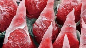 18 fotografii uimitoare: Cum arată organele noastre la microscop