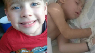 Un copil de 5 anișori suferă de tumoare malignă pe creier. Părinții disperați strigă după ajutor