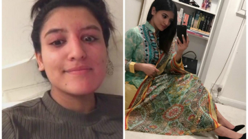 Модель, облитая кислотой, благодаря пластике выглядит лучше, чем до трагедии