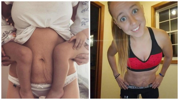 Mămicile nu-și mai ascund pielea lăsată și vergeturile de după naștere