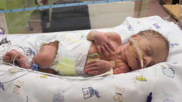 Astăzi este marcată Ziua Internațională a Prematurului