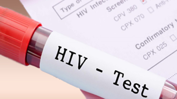 Pe 1 decembrie, doritorii pot face gratuit testul rapid la HIV pe salivă