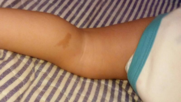 O moldoveancă a născut în Italia un copil cu harta Moldovei pe picior