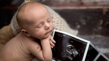 Для чего необходимо УЗИ головного мозга ребенка?