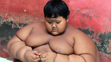 Cel mai gras copil din lume continuă cura de slăbire care îi schimbă viaţa. A dat jos 75 de kilograme (FOTO)