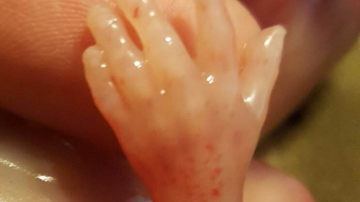 Bebeluș pierdut la 14 săptămâni. Mama îndurerată: „Nu e doar o aglomerare de celule!”