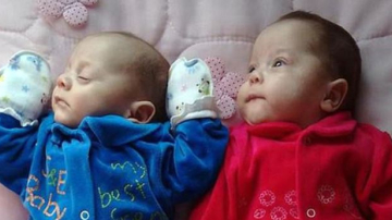 Женщина после клинической смерти родила здоровых близнецов