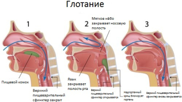 Primul ajutor, dacă vi s-a oprit ceva în gât - manevra lui Heimlich