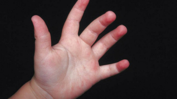 Беспрецедентный случай! Давала своему ребенку хлор в надежде излечить его от аутизма