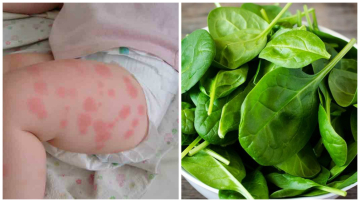 Copilul poate fi alergic la spanac?