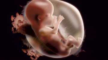 Врачи: младенцы испытывают сильные боли во время аборта