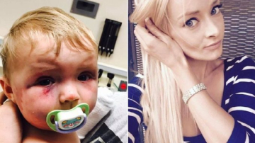 O mamă și-a bătut cu bestialitate bebelușul de 5 luni