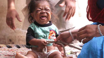 Are 23 de ani, dar arată ca un bebeluș