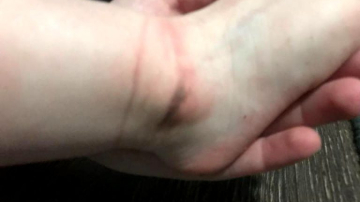 Cum a fost torturată o fetiță care obișnuia să se descalțe la grădiniță