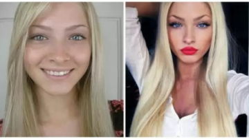 Fanii au inlemnit! Cum arata iubita lui Timati, inainte de operatiile plastice - FOTO