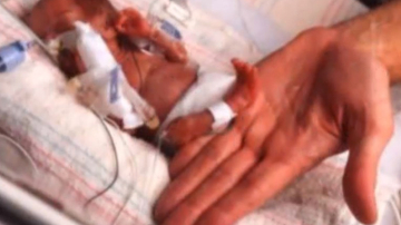 Ни один врач не стал бы спасать этого ребенка, если бы его мама не солгала о сроке беременности...