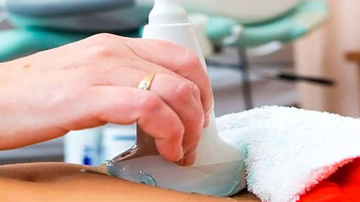 Ce este foliculometria?