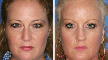 Fumatul provoacă îmbătrânirea prematură (foto)