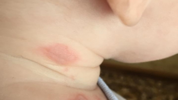 Un bebelus de 4 luni a fost ars la gat dupa ce o femeie a aruncat o tigara peste balcon - FOTO