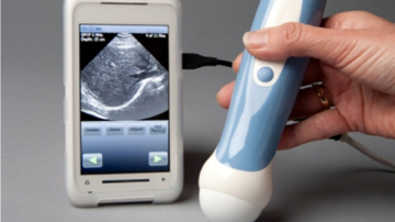 Ecografie cu ajutorul telefonului? Acum este posibil!