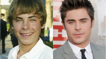 Знаменитые актеры, не раз прибегавшие к пластической хирургии ради Голливуда