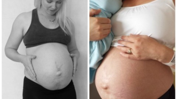 Cum arata in realitate abdomenul unei mame dupa 24 de ore