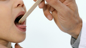 Дифтерия: диагностика, причины, лечение