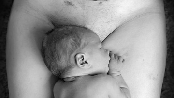 Фото женщины после кесарева сечения разделило Сеть на два лагеря