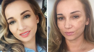 Анфиса Чехова показала лицо без тонального крема, покрытое веснушками