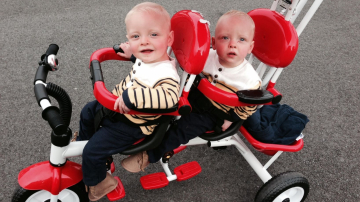 Редчайший случай! Эти близнецы родились с удивительной особенностью