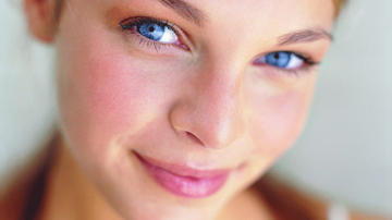 Купероз на лице: в чем причины и как с этим бороться?