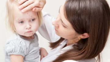 В Молдове зафиксирован сезонный всплеск ветрянки