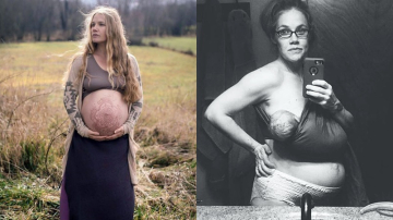 Fotografia de unei proaspete mame trădează imaginea reală a femeii după naștere