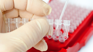 Тест на уровень глюкозы в крови станет обязательным для беременных женщин