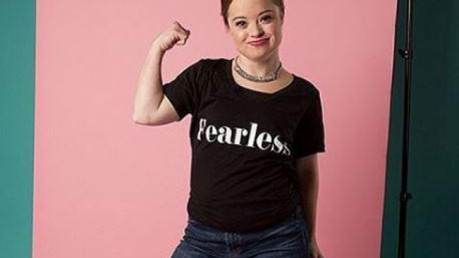 «Бесстрашная» модель с синдромом Дауна впервые стала лицом бьюти-бренда