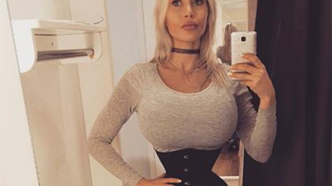 Жительница Швеции удалила шесть ребер ради тонкой талии