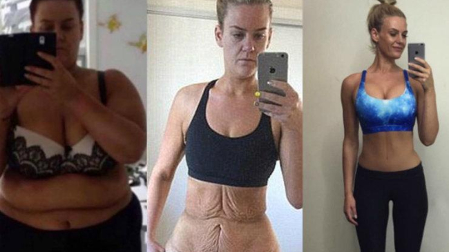 Другое тело! Американка показала результат похудения на 92 килограмма