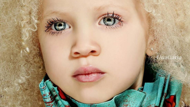 Афроамериканка-альбинос штурмует fashion-индустрию и покоряет интернет