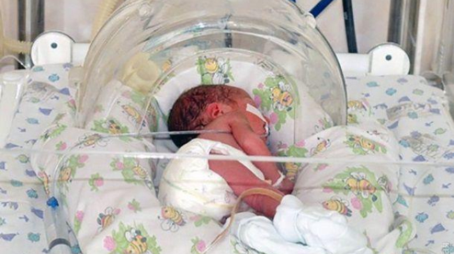 В Одессе женщина родила сразу пять детей