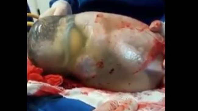 Imagini extrem de rare surprinse în timpul nașterii unui bebeluș