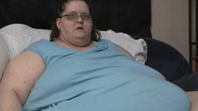 В Австралии женщина весом 272 кг родила 18-килограммового ребёнка